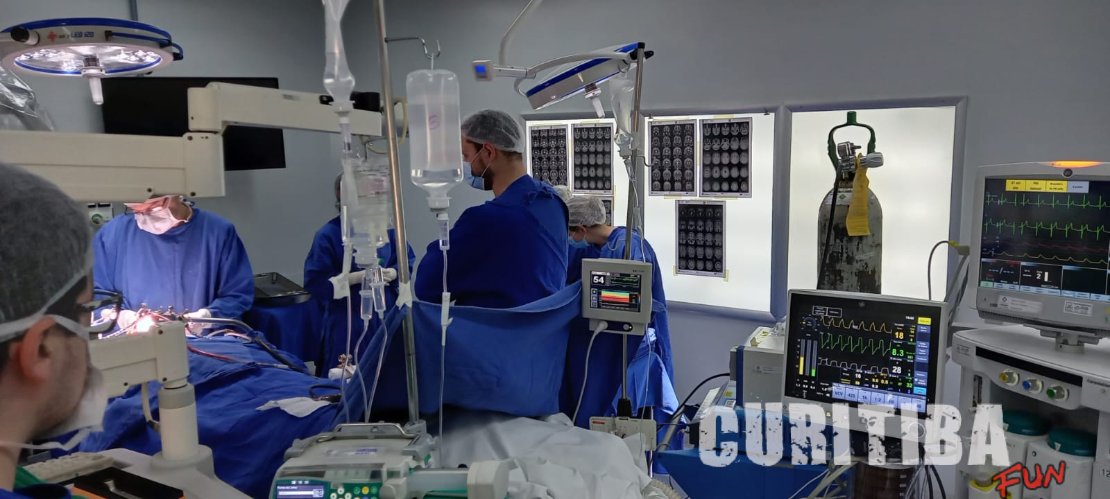 Do diagnóstico ao tratamento da epilepsia: cirurgia em hospital SUS devolve esperança para jovem que sofria convulsões