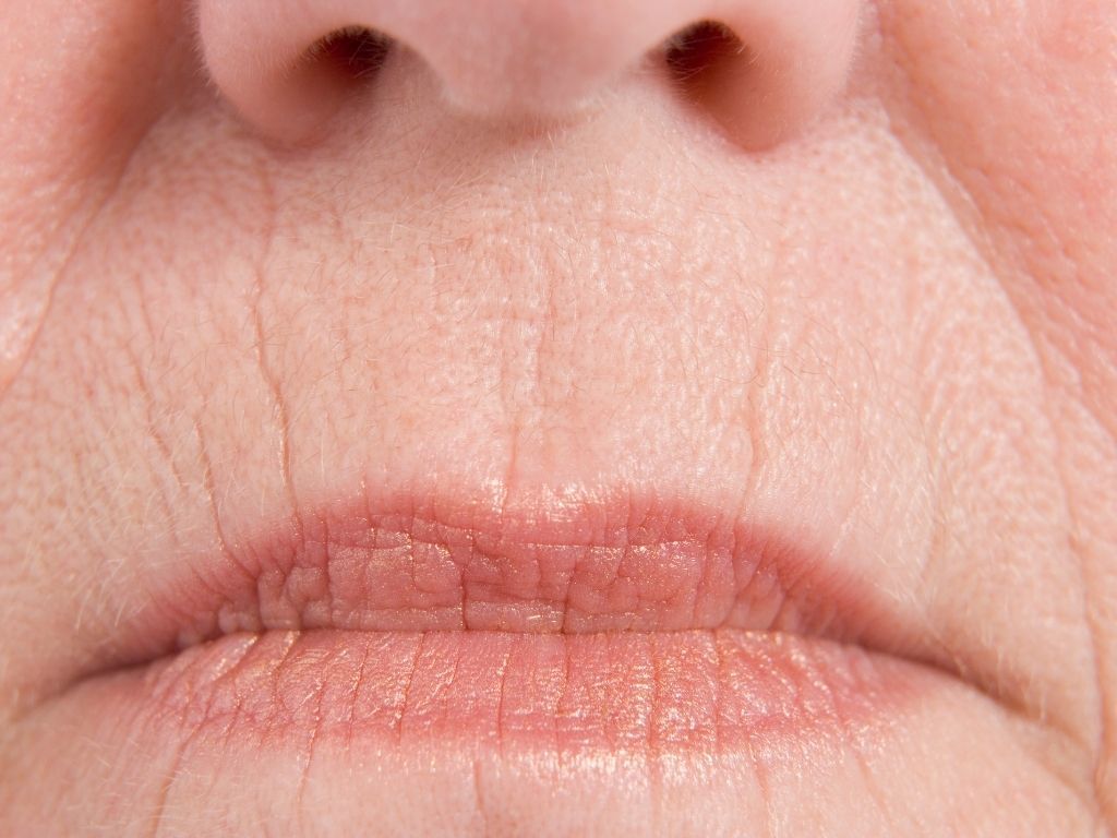 Estética: código de barras no rosto? Saiba o que é Estética: código de barras no rosto? Saiba o que é