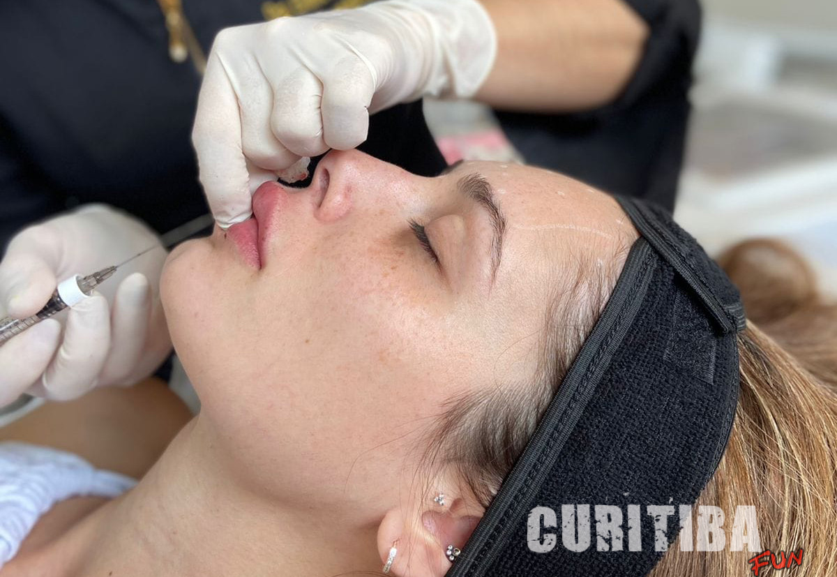 Ácido hialurônico: dê um up nos seus lábios