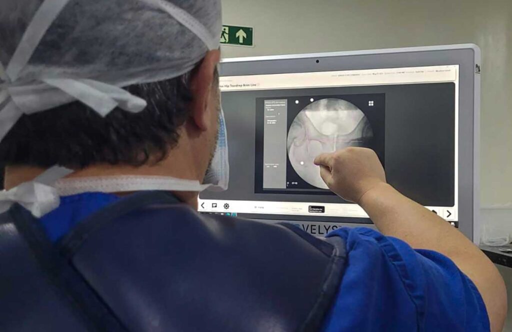 Aumento de cirurgias de quadril no Brasil demanda novas abordagens cirúrgicas Aumento de cirurgias de quadril no Brasil demanda novas abordagens cirúrgicas