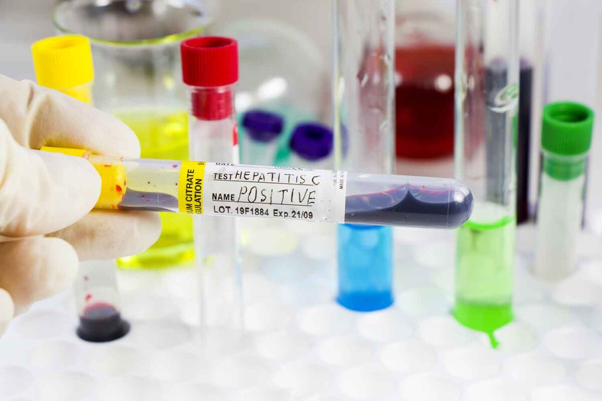 Hepatites virais: um alerta silencioso para a saúde pública