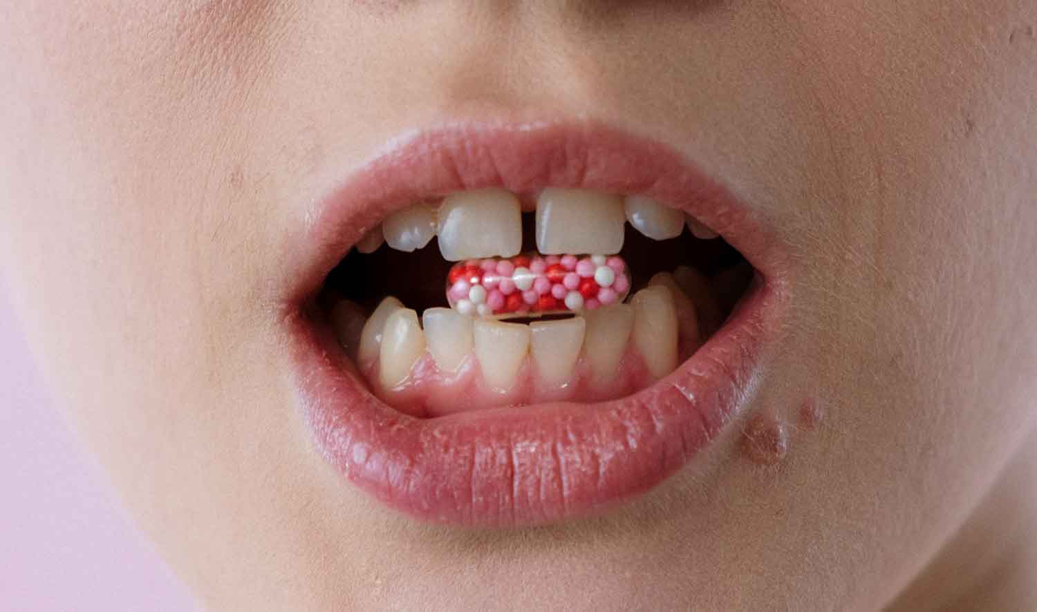 Halitose: não existe pílula mágica para curar o mau hálito