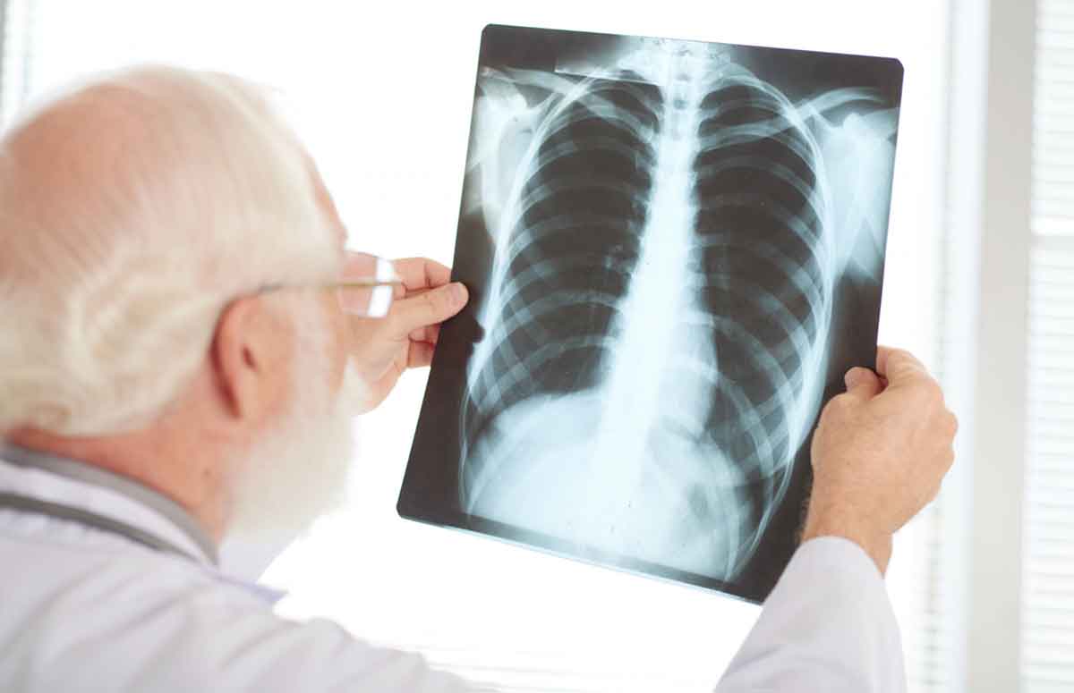 Casos de pneumonia e tuberculose são responsáveis por milhares de mortes todos os anos