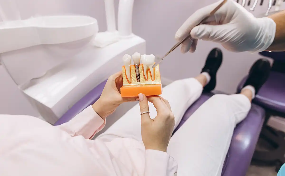 Implantes dentários: entenda qual procedimento é mais indicado para você