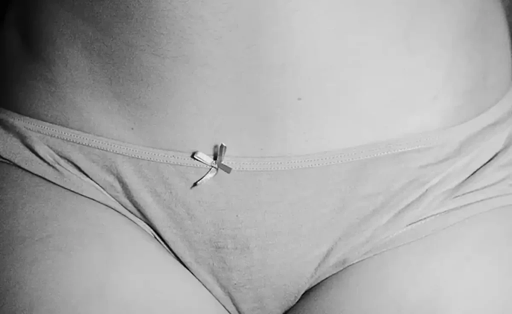 Ninfoplastia desde cedo é um direito feminino