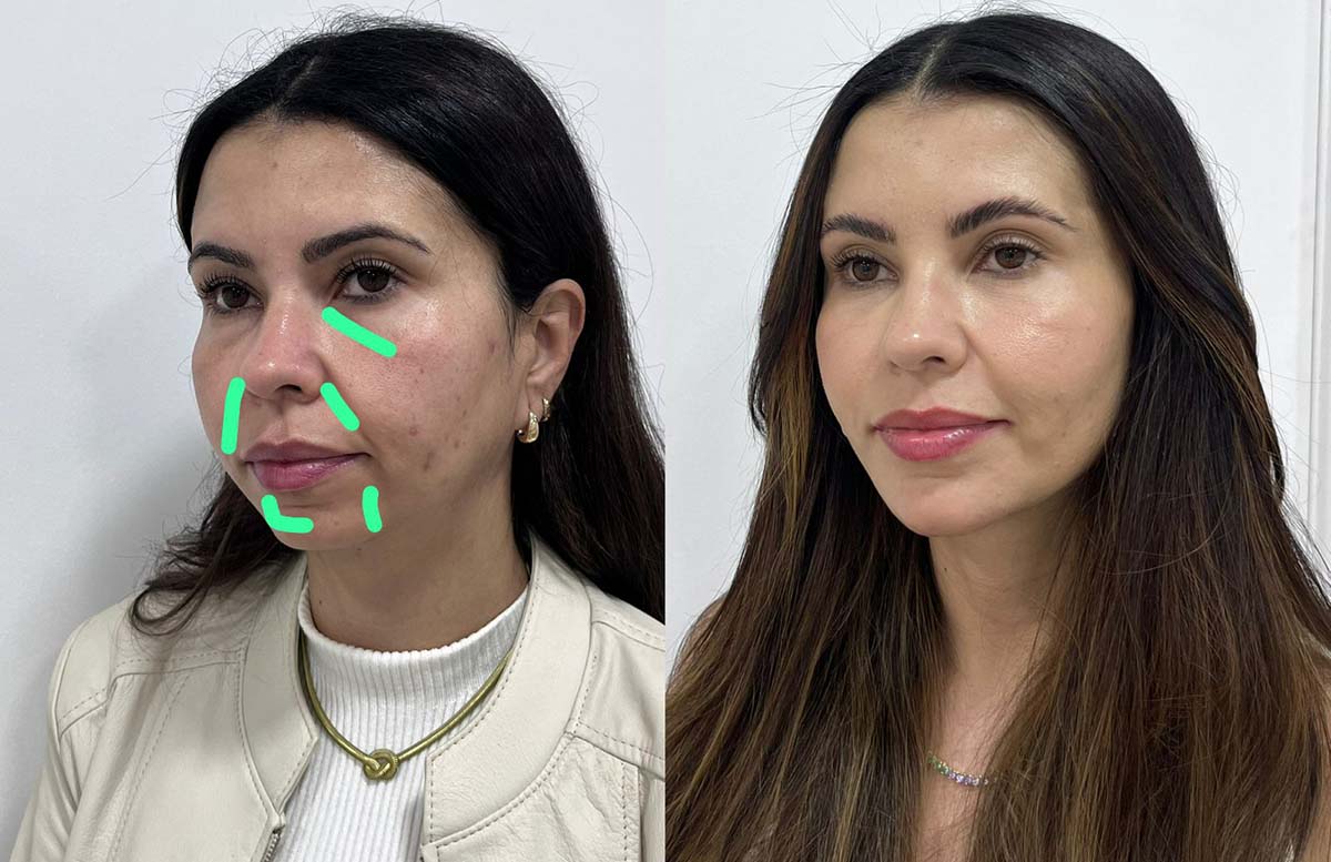 Rugas não são as maiores vilãs: especialista explica o que mais envelhece a aparência
