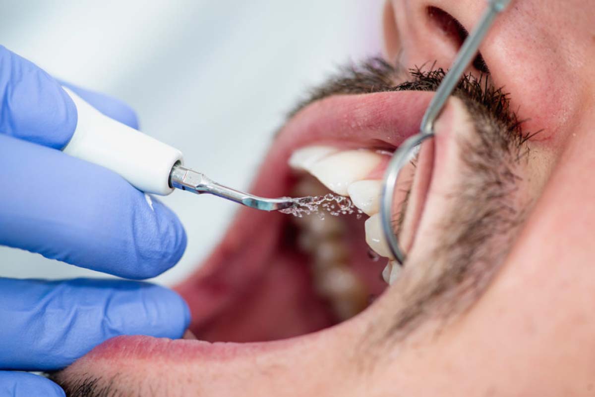 Limpeza evita problemas: o erro comum no uso do fio dental que prejudica a saúde e encarece o tratamento Limpeza evita problemas: o erro comum no uso do fio dental que prejudica a saúde e encarece o tratamento