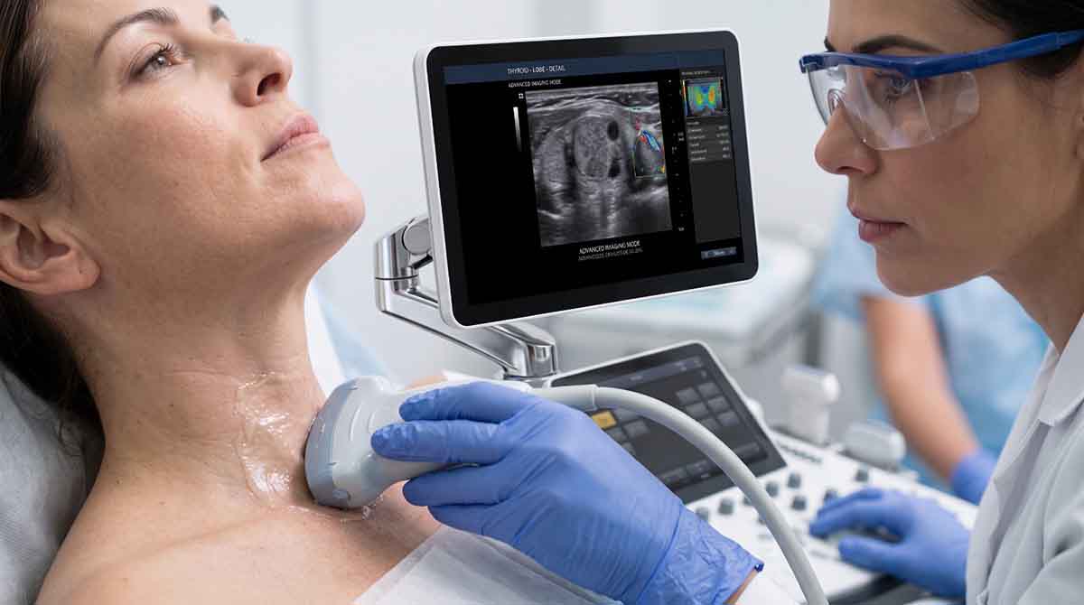 Nódulo na tireoide: quando fazer ultrassom e quando é preciso punção?